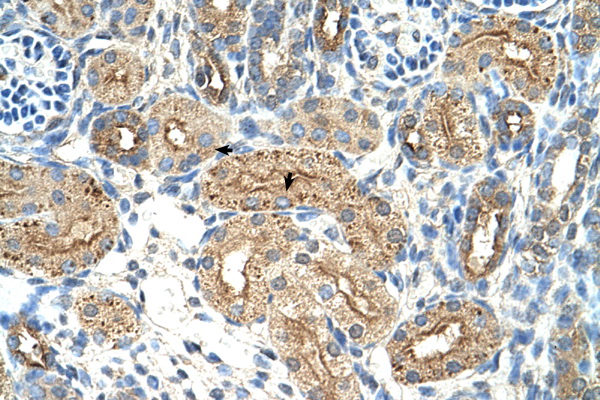 CTDSPL Antibody - CTDSPL antibody ARP42261_P050-NP_005799-CTDSPL(CTD (carboxy-terminal domain) small phosphatase-like) Antibody IHC of formalin-fixed, paraffin-embedded human Kidney. Positive label: Epithelial cells of renal tubule indicated with arrows. Antibody concentration 4-8 ug/ml. Magnification 400X.  This image was taken for the unconjugated form of this product. Other forms have not been tested.