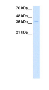 CTDSPL Antibody - CTDSPL antibody ARP42261_P050-NP_005799-CTDSPL(CTD (carboxy-terminal domain) small phosphatase-like) Antibody Western blot of DLD1 cell lysate.  This image was taken for the unconjugated form of this product. Other forms have not been tested.