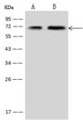 CTDSPL2 Antibody - Anti-CTDSPL2 rabbit polyclonal antibody at 1:500 dilution. Lane A: MCF-7 Whole Cell Lysate. Lane B: U-251 MG Whole Cell Lysate. Lysates/proteins at 30 ug per lane. Secondary: Goat Anti-Rabbit IgG (H+L)/HRP at 1/10000 dilution. Developed using the ECL technique. Performed under reducing conditions. Predicted band size: 53 kDa. Observed band size: 70 kDa.