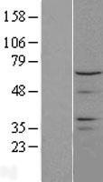 CTDSPL2 Protein - Western validation with an anti-DDK antibody * L: Control HEK293 lysate R: Over-expression lysate