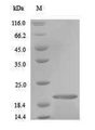Salivary Antigen 1 Protein - (Tris-Glycine gel) Discontinuous SDS-PAGE (reduced) with 5% enrichment gel and 15% separation gel.