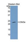 CTF1 / Cardiotrophin-1 Antibody - Western blot of recombinant CFT1 / CT-1 / Cardiotrophin-1.  This image was taken for the unconjugated form of this product. Other forms have not been tested.