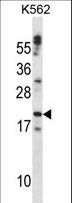 CTF1 / Cardiotrophin-1 Antibody - CTF1 Antibody western blot of K562 cell line lysates (35 ug/lane). The CTF1 antibody detected the CTF1 protein (arrow).