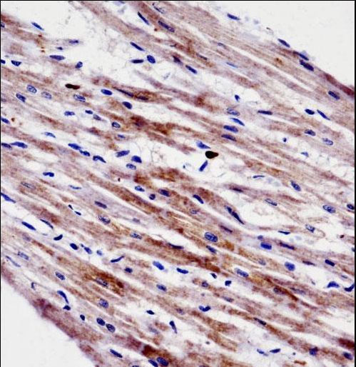 CTF1 / Cardiotrophin-1 Antibody - CTF1 Antibody immunohistochemistry of formalin-fixed and paraffin-embedded human heart tissue followed by peroxidase-conjugated secondary antibody and DAB staining.