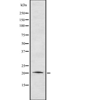CTF1 / Cardiotrophin-1 Antibody - Western blot analysis of Cardiotrophin-1 using COLO205 whole cells lysates