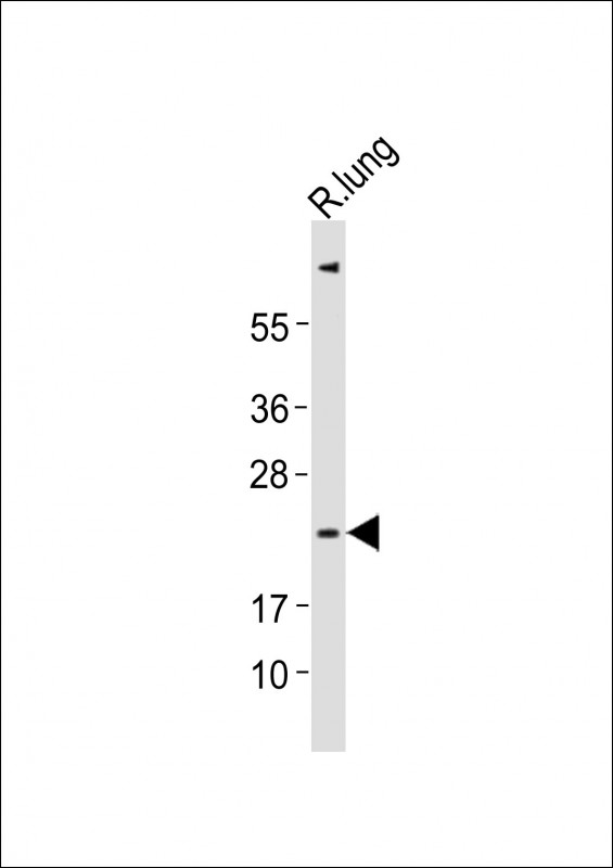 CTF1 / Cardiotrophin-1 Antibody - Anti-Ctf1 Antibody at 1:2000 dilution + rat lung lysates Lysates/proteins at 20 ug per lane. Secondary Goat Anti-Rabbit IgG, (H+L), Peroxidase conjugated at 1/10000 dilution Predicted band size : 22 kDa Blocking/Dilution buffer: 5% NFDM/TBST.