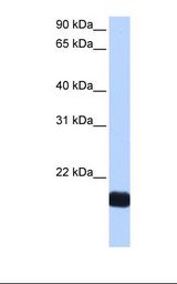 CTF1 / Cardiotrophin-1 Antibody - HEPG2 cell lysate. Antibody concentration: 0.5 ug/ml. Gel concentration: 12%.  This image was taken for the unconjugated form of this product. Other forms have not been tested.