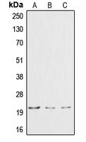 CTF1 / Cardiotrophin-1 Antibody - Western blot analysis of Cardiotrophin-1 expression in HepG2 (A); HeLa (B); Jurkat (C) whole cell lysates.