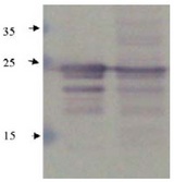 CTF1 / Cardiotrophin-1 Antibody - Immunodetection Analysis: Representative blot from a previous lot. Lane 1.recombinant protein CT-1. Lane 2. HepG2 cell lysate. The membrane blot wasprobed with anti-CT-1 primary antibody(0.25?g/ml).Proteins were visualized using a goat anti-rabbitsecondary antibody conjugated to HRP andchemiluminescence detection system. Arrows indicatecellular CT-1 from human and mouse cells (24 kDa).