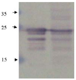 CTF1 / Cardiotrophin-1 Antibody - Immunodetection Analysis: Representative blot from a previous lot. Lane 1.recombinant protein CT-1. Lane 2. HepG2 cell lysate. The membrane blot wasprobed with anti-CT-1 primary antibody(0.25?g/ml).Proteins were visualized using a goat anti-rabbitsecondary antibody conjugated to HRP andchemiluminescence detection system. Arrows indicatecellular CT-1 from human and mouse cells (24 kDa).