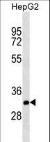 CTG-B45d / THAP11 Antibody - THAP11 Antibody western blot of HepG2 cell line lysates (35 ug/lane). The THAP11 antibody detected the THAP11 protein (arrow).