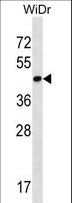 CTG-B45d / THAP11 Antibody - THAP11 Antibody western blot of WiDr cell line lysates (35 ug/lane). The THAP11 antibody detected the THAP11 protein (arrow).