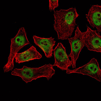 CTG-B45d / THAP11 Antibody - Immunofluorescence of NTERA-2 cells using THAP11 mouse monoclonal antibody (green). Red: Actin filaments have been labeled with Alexa Fluor-555 phalloidin.