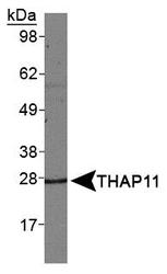 CTG-B45d / THAP11 Antibody - THAP11 Antibody - Western blot of THAP11 in HeLa whole cell extracts.