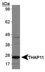 CTG-B45d / THAP11 Antibody - THAP11 Antibody - Western blot of THAP11 in HepG2 whole cell lysates.