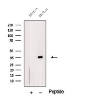 CTG-B45d / THAP11 Antibody - Western blot analysis of extracts of HeLa cells using THA11 antibody. The lane on the left was treated with blocking peptide.