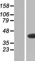 CTG-B45d / THAP11 Protein - Western validation with an anti-DDK antibody * L: Control HEK293 lysate R: Over-expression lysate