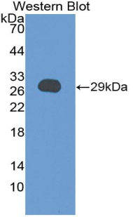 CTGF Antibody - Western blot of recombinant CTGF.