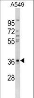 CTGF Antibody - CTGF Antibody western blot of A549 cell line lysates (35 ug/lane). The CTGF antibody detected the CTGF protein (arrow).
