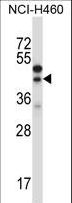 CTGF Antibody - CTGF Antibody western blot of NCI-H460 cell line lysates (35 ug/lane). The CTGF antibody detected the CTGF protein (arrow).