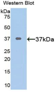 CTGF Antibody - Western blot of recombinant CTGF.  This image was taken for the unconjugated form of this product. Other forms have not been tested.