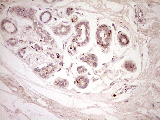CTGF Antibody - Immunohistochemical staining of paraffin-embedded Human breast tissue within the normal limits using anti-CTGF mouse monoclonal antibody. (Heat-induced epitope retrieval by 1 mM EDTA in 10mM Tris, pH8.5, 120C for 3min,
