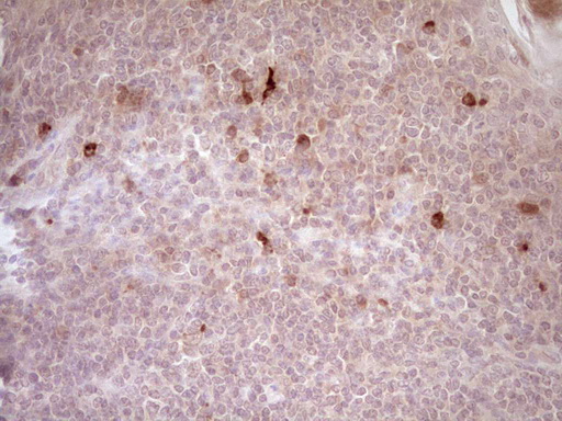 CTGF Antibody - Immunohistochemical staining of paraffin-embedded Human tonsil within the normal limits using anti-CTGF mouse monoclonal antibody. (Heat-induced epitope retrieval by 1 mM EDTA in 10mM Tris, pH8.5, 120C for 3min,