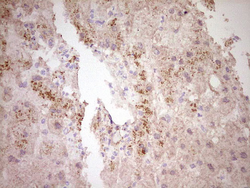 CTGF Antibody - Immunohistochemical staining of paraffin-embedded Human liver tissue within the normal limits using anti-CTGF mouse monoclonal antibody. (Heat-induced epitope retrieval by 1 mM EDTA in 10mM Tris, pH8.5, 120C for 3min,