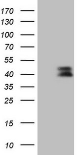 CTGF Antibody - HEK293T cells were transfected with the pCMV6-ENTRY control (Left lane) or pCMV6-ENTRY CTGF (Right lane) cDNA for 48 hrs and lysed. Equivalent amounts of cell lysates (5 ug per lane) were separated by SDS-PAGE and immunoblotted with anti-CTGF.