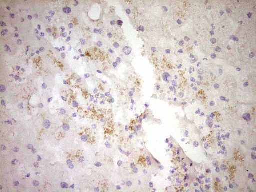 CTGF Antibody - IHC of paraffin-embedded Human liver tissue using anti-CTGF mouse monoclonal antibody. (Heat-induced epitope retrieval by 1 mM EDTA in 10mM Tris, pH8.5, 120°C for 3min).