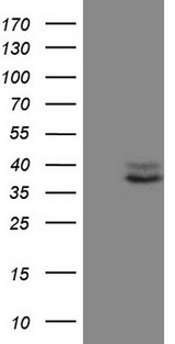 CTGF Antibody - HEK293T cells were transfected with the pCMV6-ENTRY control (Left lane) or pCMV6-ENTRY CTGF (Right lane) cDNA for 48 hrs and lysed. Equivalent amounts of cell lysates (5 ug per lane) were separated by SDS-PAGE and immunoblotted with anti-CTGF.