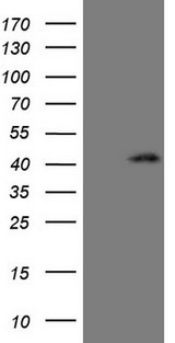 CTGF Antibody - HEK293T cells were transfected with the pCMV6-ENTRY control (Left lane) or pCMV6-ENTRY CTGF (Right lane) cDNA for 48 hrs and lysed. Equivalent amounts of cell lysates (5 ug per lane) were separated by SDS-PAGE and immunoblotted with anti-CTGF.