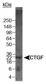 CTGF Antibody - Detection of CTGF in mouse kidney lysate. 5 sec. ECL exposure.  This image was taken for the unconjugated form of this product. Other forms have not been tested.