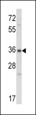 CTGF Antibody - Western blot of CTGF Antibody in NCI-H460 cell line lysates (35 ug/lane). CTGF (arrow) was detected using the purified antibody.