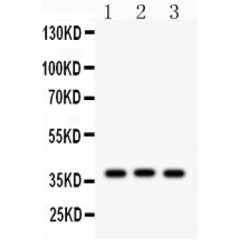 CTGF Antibody - CTGF antibody Western blot. All lanes: Anti CTGF at 0.5 ug/ml. Lane 1: Rat Liver Tissue Lysate at 50 ug. Lane 2: Rat Thymus Tissue Lysate at 50 ug. Lane 3: HELA Whole Cell Lysate at 40 ug. Predicted band size: 38 kD. Observed band size: 38 kD.