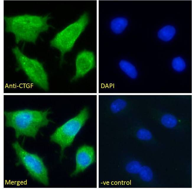 CTGF Antibody - Immunofluorescence analysis of paraformaldehyde fixed HepG2 cells, permeabilized with 0.15% Triton. Primary incubation 1hr (10ug/ml) followed by Alexa Fluor 488 secondary antibody (2ug/ml), showing cytoplasmic and extracellular staining. The nuclear stain is DAPI (blue). Negative control: Unimmunized goat IgG (10ug/ml) followed by Alexa Fluor 488 secondary antibody (2ug/ml).