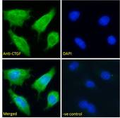 CTGF Antibody - Immunofluorescence analysis of paraformaldehyde fixed HepG2 cells, permeabilized with 0.15% Triton. Primary incubation 1hr (10ug/ml) followed by Alexa Fluor 488 secondary antibody (2ug/ml), showing cytoplasmic and extracellular staining. The nuclear stain is DAPI (blue). Negative control: Unimmunized goat IgG (10ug/ml) followed by Alexa Fluor 488 secondary antibody (2ug/ml).