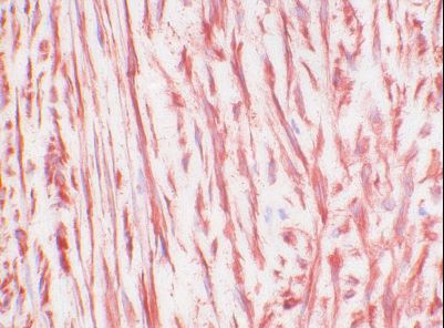 CTGF Antibody - IHC of CTGF antibody. Frozen section of human umbilical cord.
