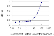 CTGF Antibody - Detection limit for recombinant GST tagged CTGF is 1 ng/ml as a capture antibody.