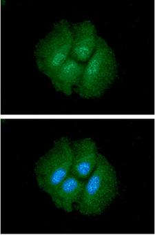 CTGF Antibody - ICC/IF analysis of CTGF in Hep3B cells. The cell was stained with CTGF antibody (1:100).The secondary antibody (green) was used Alexa Fluor 488. DAPI was stained the cell nucleus (blue).