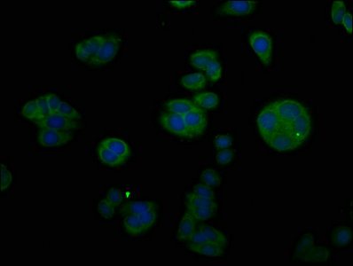CTGF Antibody - Immunofluorescent analysis of HepG2 cells using CTGF Antibody at dilution of 1:100 and Alexa Fluor 488-congugated AffiniPure Goat Anti-Rabbit IgG(H+L)