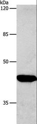 CTGF Antibody - Western blot analysis of HeLa cell, using CTGF Polyclonal Antibody at dilution of 1:850.