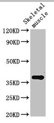 CTGF Antibody - Western Blot Positive WB detected in:Rat skeletal muscle tissue All Lanes:Ctgf antibody at 3µg/ml Secondary Goat polyclonal to rabbit IgG at 1/50000 dilution Predicted band size: 38 KDa Observed band size: 38 KDa