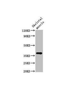 CTGF Antibody - Western Blot Positive WB detected in: Rat skeletal muscle tissue All lanes: Ctgf antibody at 3µg/ml Secondary Goat polyclonal to rabbit IgG at 1/50000 dilution Predicted band size: 38 kDa Observed band size: 38 kDa