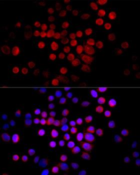 CTGF Antibody - Immunofluorescence analysis of HeLa cells using CTGF antibody at dilution of 1:100 (40x lens). Blue: DAPI for nuclear staining.