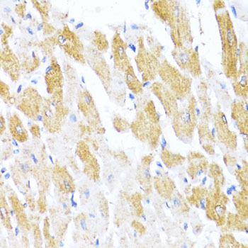 CTGF Antibody - Immunohistochemistry of paraffin-embedded rat heart using CTGF antibody at dilution of 1:100 (40x lens).