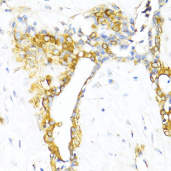 CTGF Antibody - Immunohistochemistry of paraffin-embedded human breast using CTGF antibody at dilution of 1:100 (40x lens).