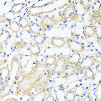 CTGF Antibody - Immunohistochemistry of paraffin-embedded mouse kidney using CTGF antibody at dilution of 1:100 (40x lens).