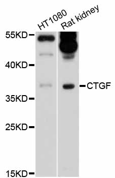 CTGF Antibody - Western blot analysis of extracts of various cell lines, using CTGF antibody at 1:1000 dilution. The secondary antibody used was an HRP Goat Anti-Rabbit IgG (H+L) at 1:10000 dilution. Lysates were loaded 25ug per lane and 3% nonfat dry milk in TBST was used for blocking. An ECL Kit was used for detection and the exposure time was 30s.