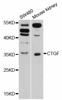CTGF Antibody - Western blot analysis of extracts of various cell lines, using CTGF antibody at 1:1000 dilution. The secondary antibody used was an HRP Goat Anti-Rabbit IgG (H+L) at 1:10000 dilution. Lysates were loaded 25ug per lane and 3% nonfat dry milk in TBST was used for blocking. An ECL Kit was used for detection and the exposure time was 60s.